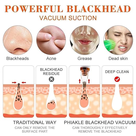 6 in 1 Multi-function Blackhead Remover Tools | Electric Derma suction Machine | USB Rechargeable Acne Pimple Pore Cleaner Vacuum tool | Facial Cleanser Device for Nose & Skin Care