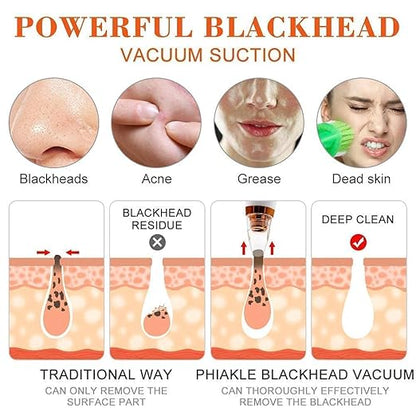 6 in 1 Multi-function Blackhead Remover Tools | Electric Derma suction Machine | USB Rechargeable Acne Pimple Pore Cleaner Vacuum tool | Facial Cleanser Device for Nose & Skin Care